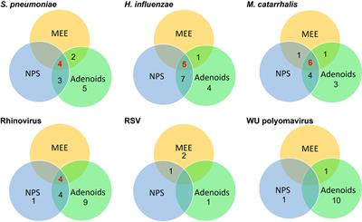 Predominant Bacterial and Viral Otopathogens Identified Within the Respiratory Tract and Middle Ear of Urban Australian Children Experiencing Otitis Media Are Diversely Distributed